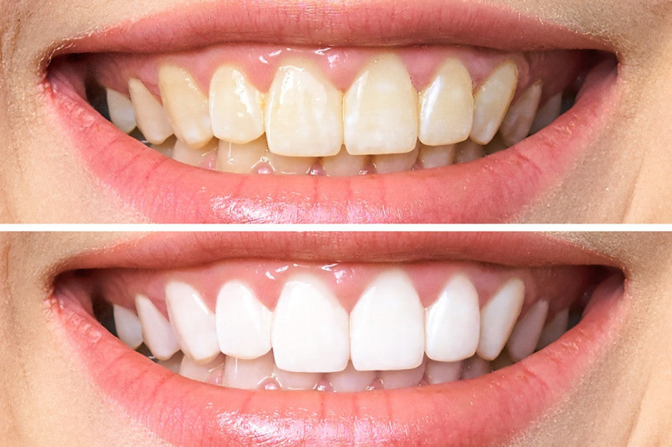 Purple whitening toothpaste